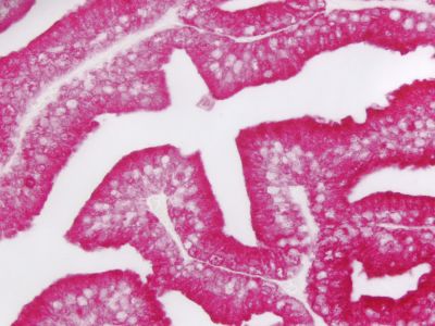 ImmPRESS? Duet Double Staining Polymer Kit (HRP – Anti-Rabbit IgG-brown, AP – Anti-Mouse IgG-magenta)