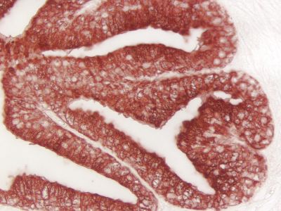 ImmPRESS? Duet Double Staining Polymer Kit (HRP – Anti-Rabbit IgG-brown, AP – Anti-Mouse IgG-magenta)