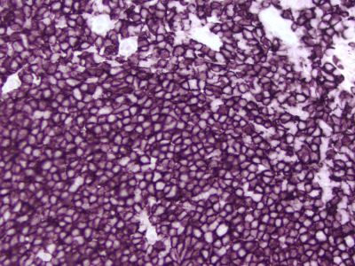 ImmPRESS? HRP Horse Anti-Mouse IgG Polymer Detection Kit,  Peroxidase