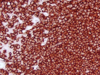 ImmPRESS? HRP Horse Anti-Mouse IgG Polymer Detection Kit,  Peroxidase