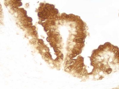 ImmPRESS? HRP Horse Anti-Mouse IgG Polymer Detection Kit,  Peroxidase